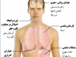 965 نفر درهند براثر ابتلا به انفلوانزای خوکی جان باختند