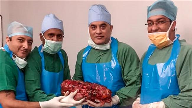 Indian doctors remove giant 7.4 kilo kidney from man