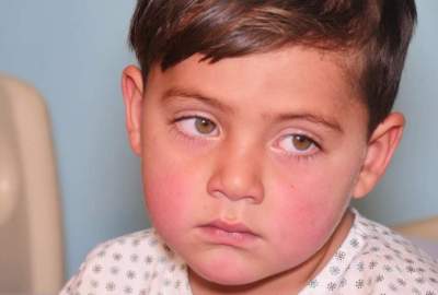 ARCS Treats 20 Children with Heart Diseases in Kabul