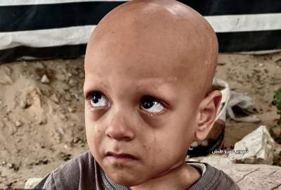 شهادت کودک فلسطینی در سایه گرسنگی و کمبود درمان در غزه