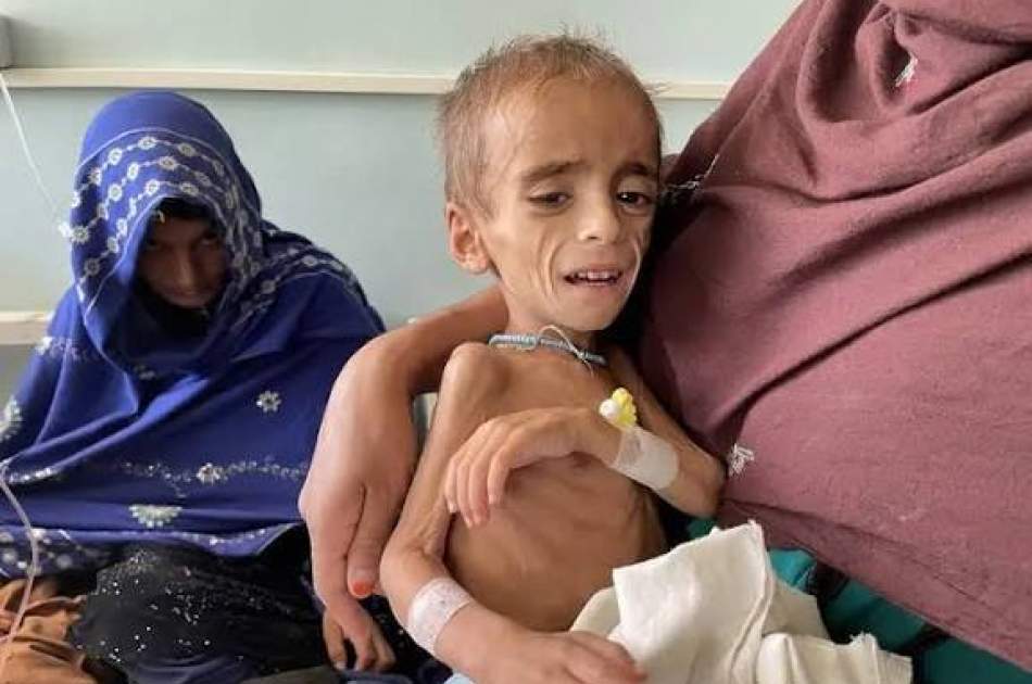اليونيسف: 3.5 مليون طفل في أفغانستان يعانون من سوء تغذية حاد